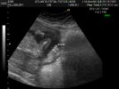 P_22.JPG